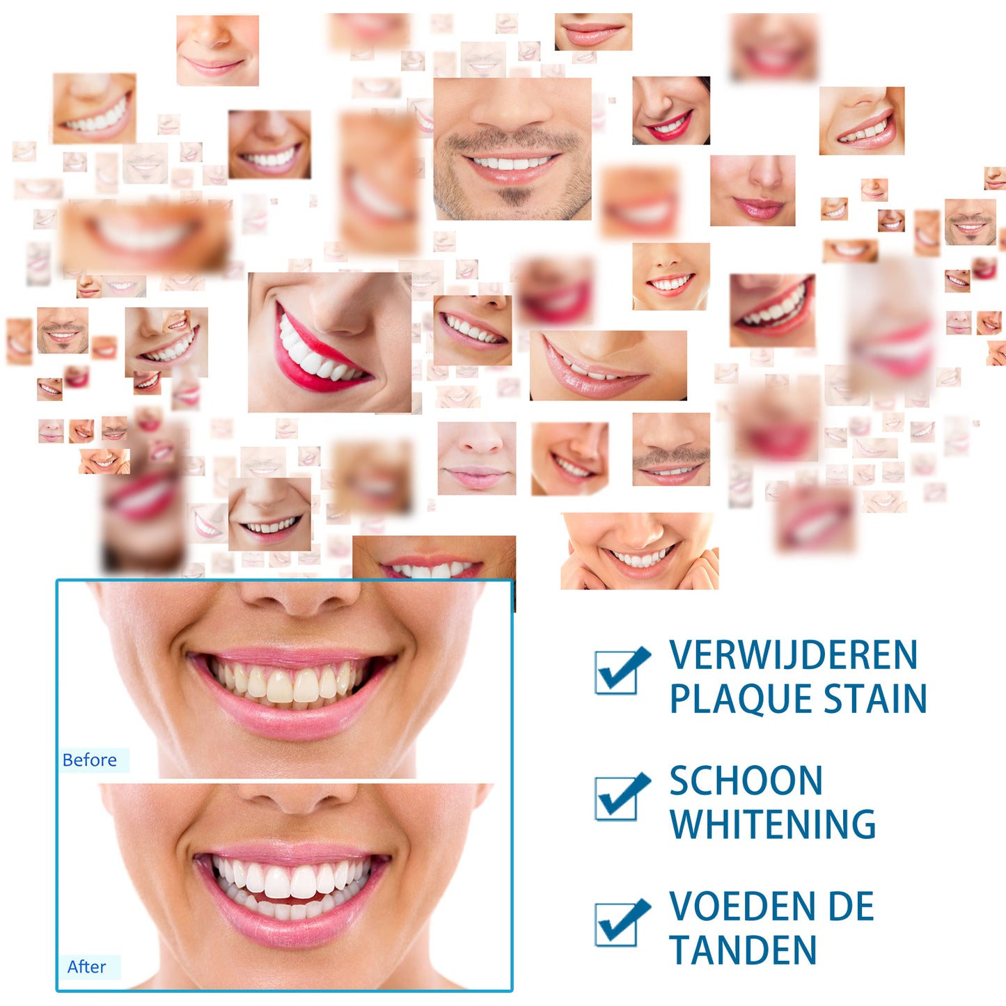 Jaysuing BrightSmile Teeth Whitening Pen – Instant Stain Removal & Shine Booster