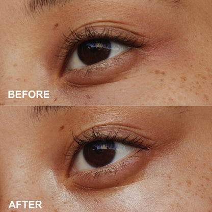 PHOFAY Anti-Wrinkle Eye Repair Cream – Firming & Hydrating Formula