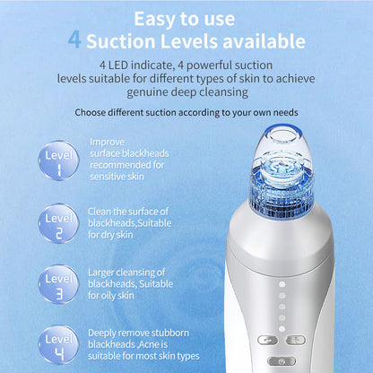 ProClean Electric Blackhead Vacuum – Deep Pore Suction & Acne Removal Device