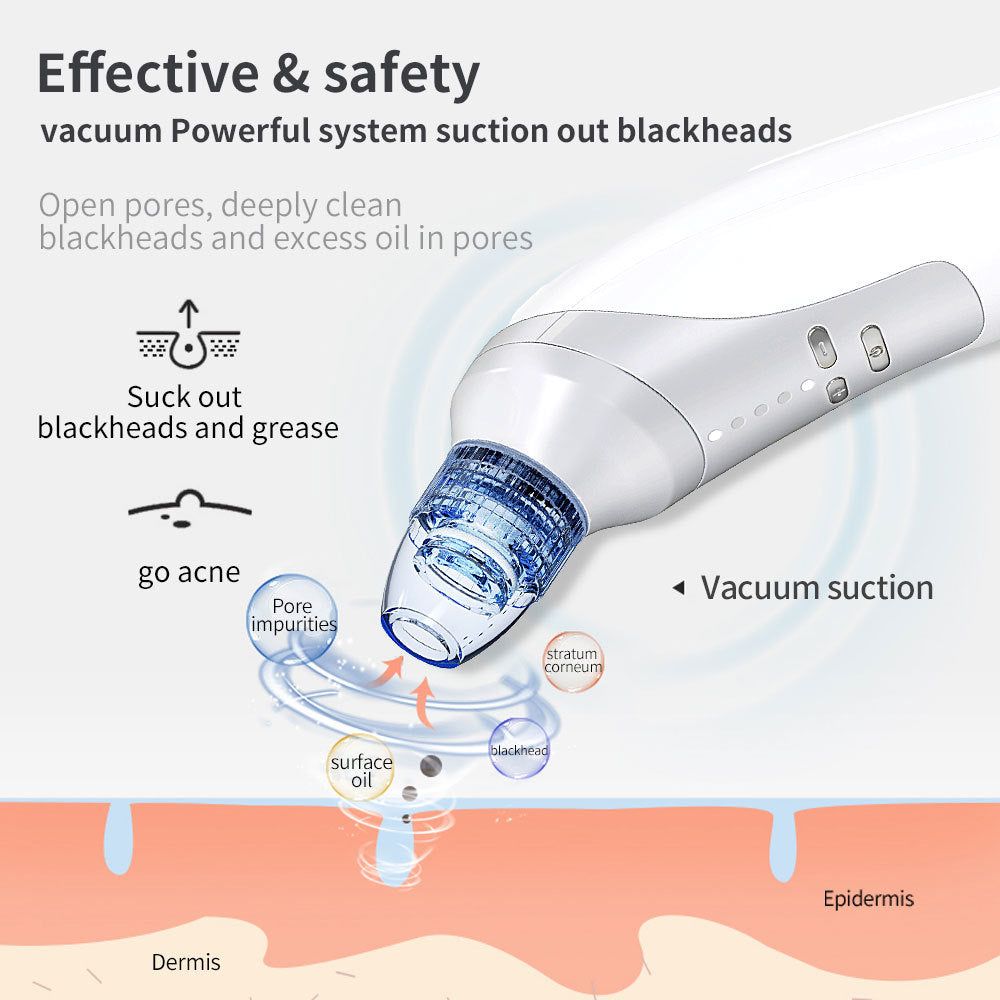 ProClean Electric Blackhead Vacuum – Deep Pore Suction & Acne Removal Device
