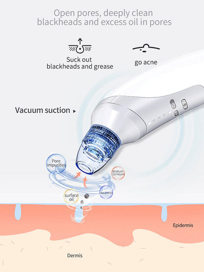 ProClean Electric Blackhead Vacuum – Deep Pore Suction & Acne Removal Device